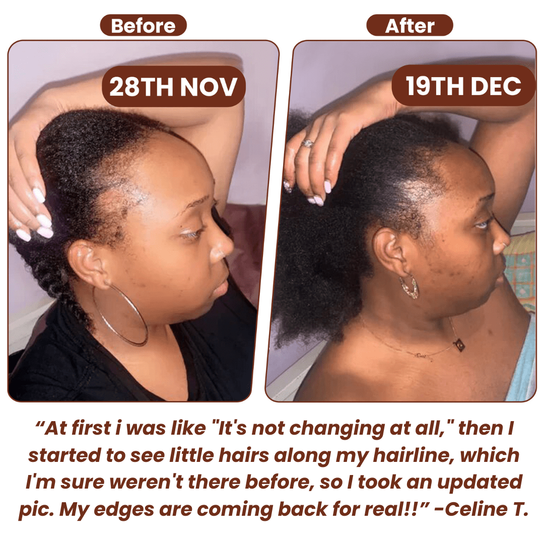 Batana Natural Hair Growth Oil - ItsHairWeGrow