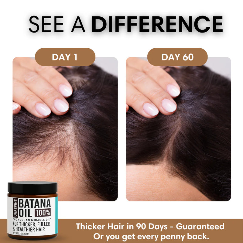 7. Breakage Disguised as Hair Loss
